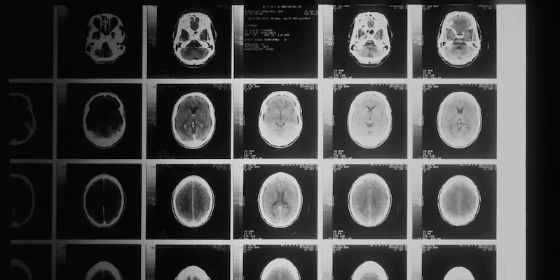 L’ applicazione dell’ intelligenza artificiale negli ospedali L’ applicazione dell’ intelligenza artificiale negli ospedali