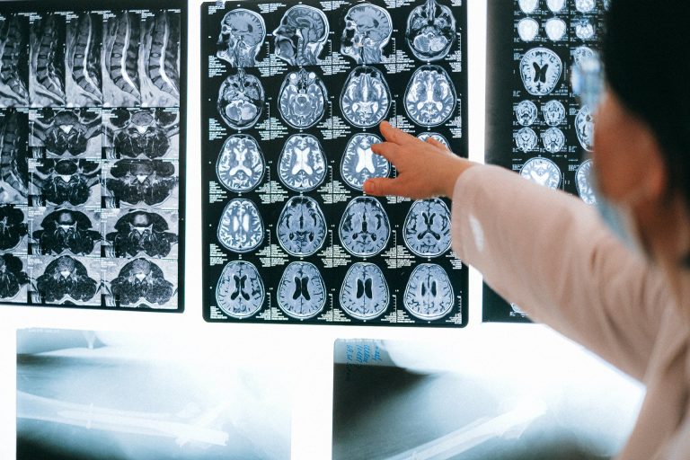 I ricercatori stanno creando una mappa digitale del cervello umano I ricercatori stanno creando una mappa digitale del cervello umano