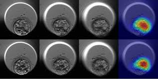 Intelligenza artificiale: può crescere un feto? Intelligenza artificiale: può crescere un feto?