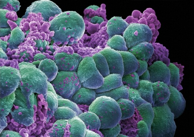 Metastasi in miniatura per sperimentare i farmaci anticancro