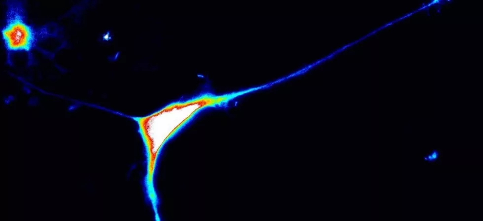 Studio di UniTo scopre un nuovo gene responsabile dell’autismo Studio di UniTo scopre un nuovo gene responsabile dell’autismo