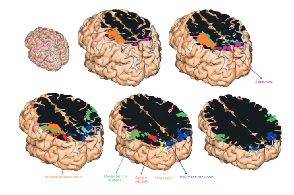 Ora le immagini “catturano” il cervello in funzione Ora le immagini “catturano” il cervello in funzione